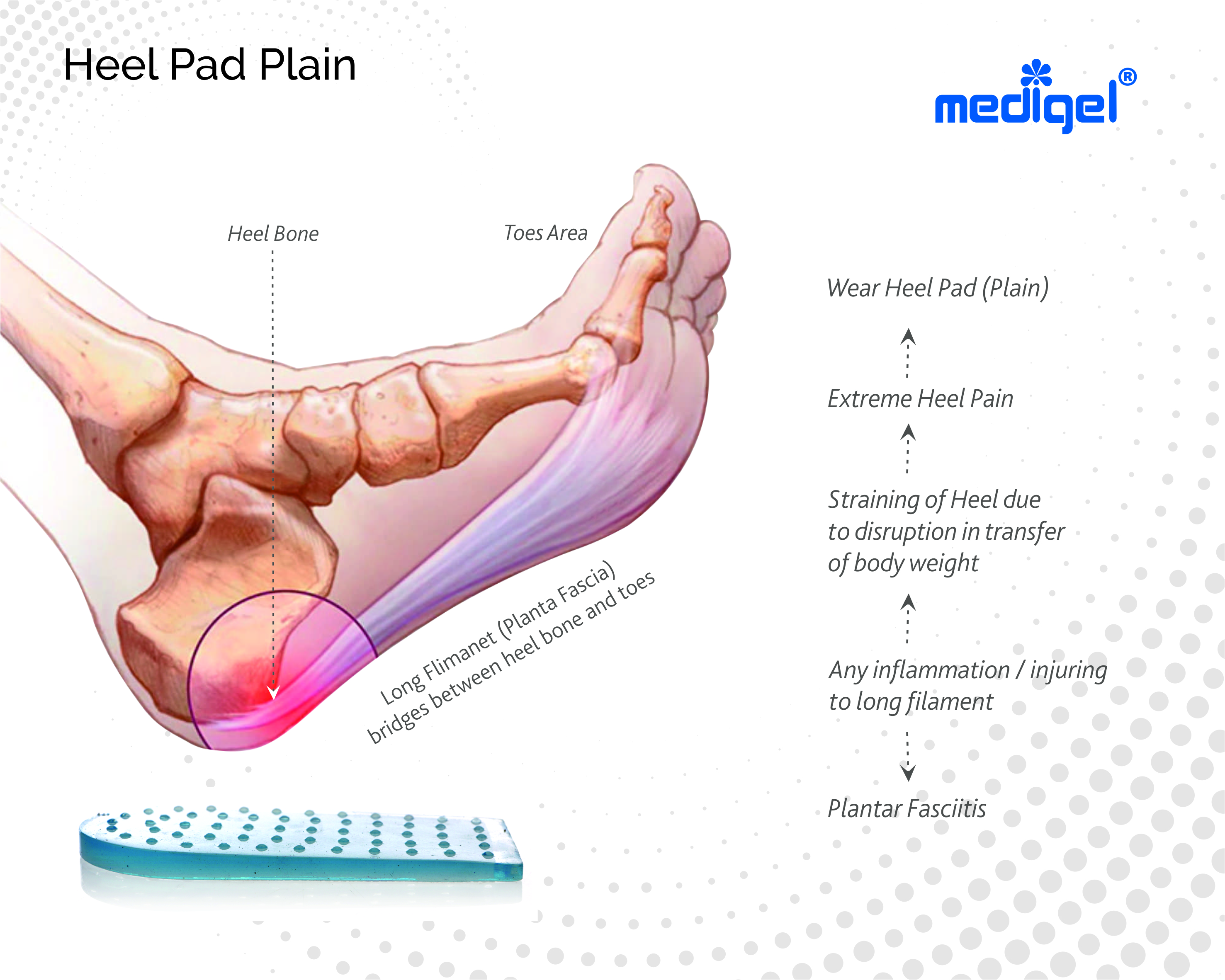 Medigel® Heel Pad Plain 