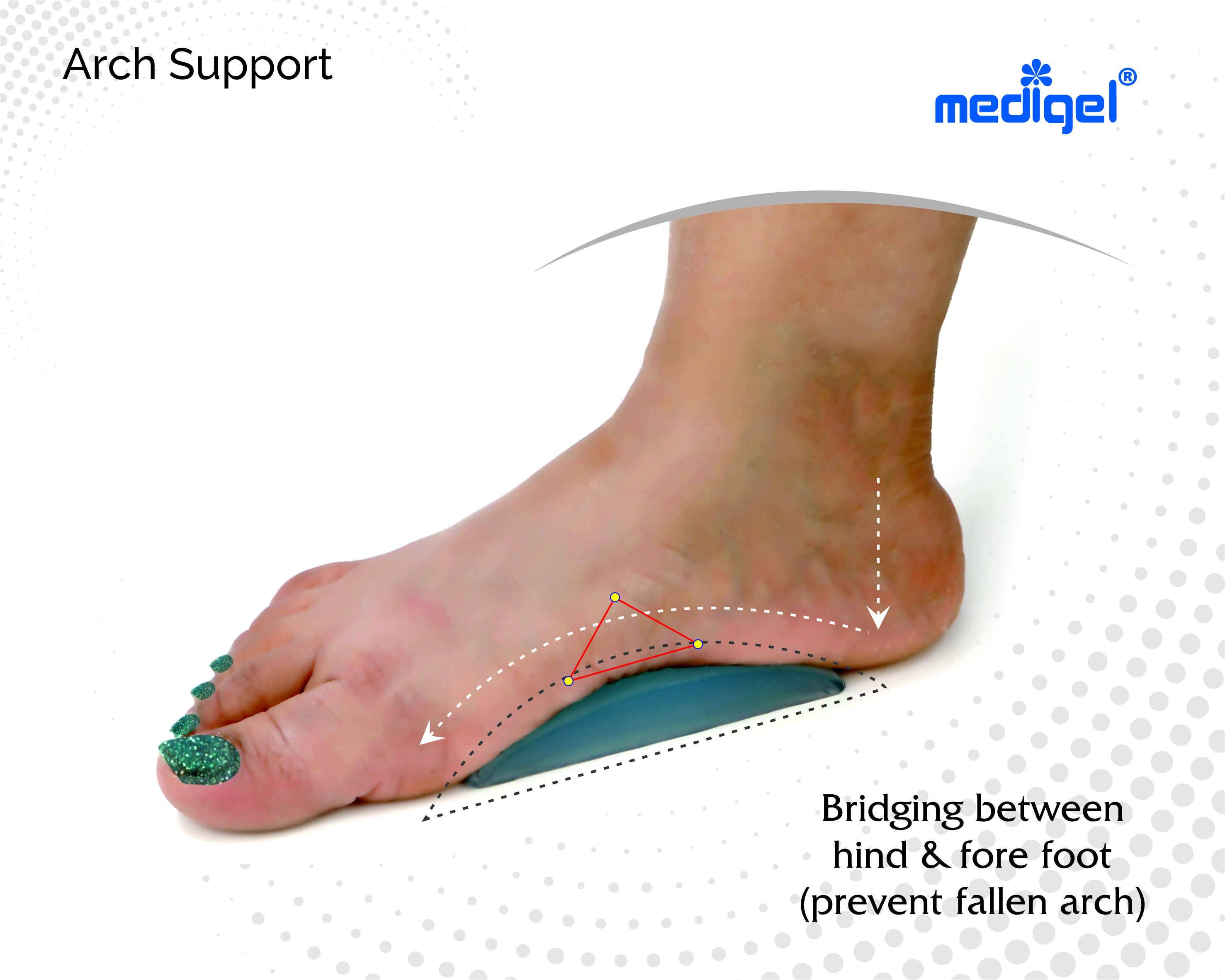 Medigel® Arch Support (Extra Small, Small, Medium, Large)